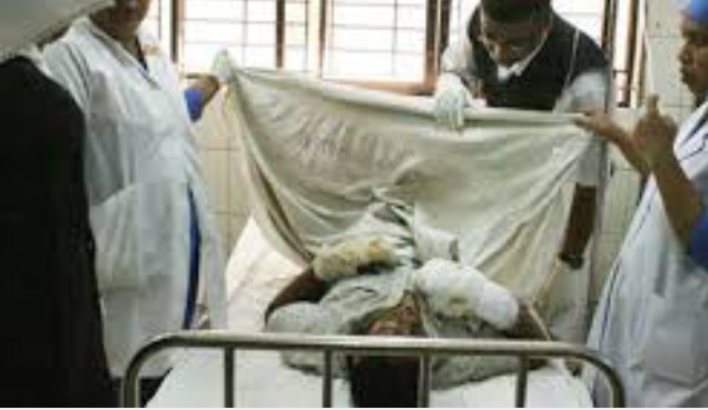 স্বামী-শাশুড়ির বর্বরতা : এসিড দগ্ধ গৃহবধু ।। একমাস পর মৃত্যু