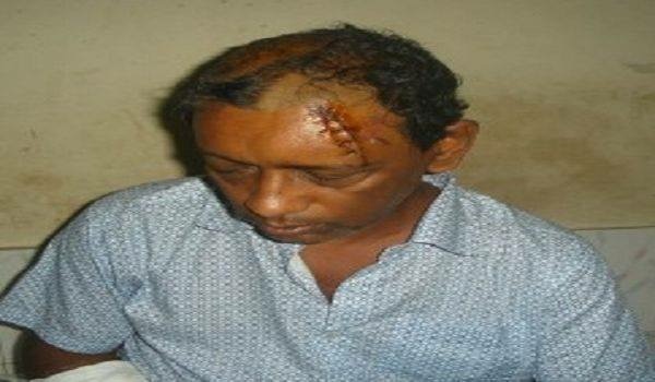 প্রতিপক্ষের সশস্ত্র হামলায় গুরুতর আহত নবনির্বাচিত ইউপি চেয়ারম্যান বরিশাল মেডিকেলে.......