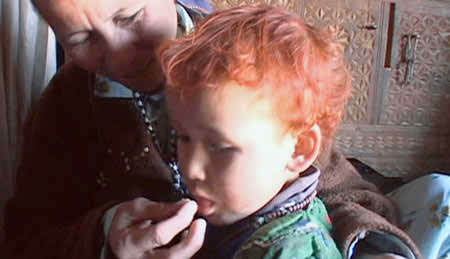 বুলেটে নয়, সেন্ট্রাল আফ্রিকানের শিশুরা মরছে অপুষ্টি রোগে ।।