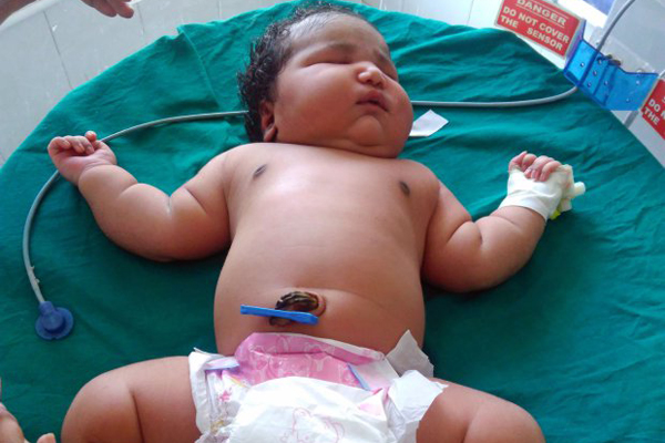 বিশ্বের সবচেয়ে বড় কন্যাশিশুর জন্ম ভারতে।। স্বাভাবিকের চেয়ে দিগুন এই নবজাতক...