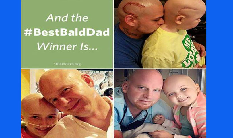 অস্ত্রোপচারের ফলে ছেলের মাথায় ক্ষতের দাগ স্পষ্ট: মাথায় একই আকৃতির ট্যাটু করে পুরস্কৃত বাবা!