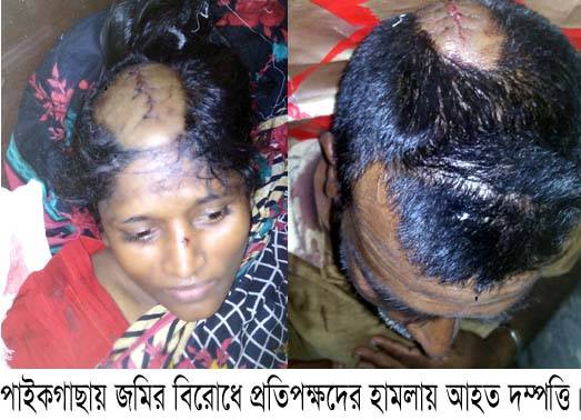 পাইকগাছায় জমি দখলে বাঁধা প্রতিপক্ষদের হামলায় দম্পত্তিসহ আহত ৩, দু’জনের অবস্থা গুরুতর