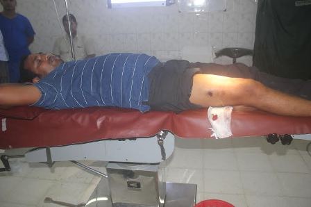 আশুলিয়ায় প্রকাশ্যে ব্যাংকের সেলস ম্যানেজারকে গুলি করে নগদ টাকা ছিনতাইয়ের চেষ্টা ......