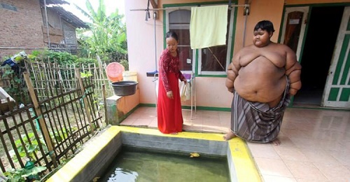 মাত্র ১০ বছরের শিশুর ওজন ১৯২ কেজি ।।