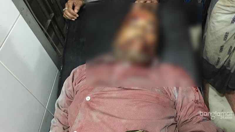 দুর্বৃত্তদের গুলিতে খুন টেকনাফের সদর আওয়ামী লীগ সভাপতি।।