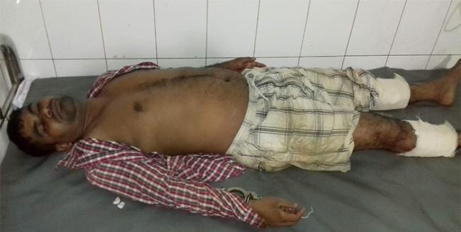 রাজধানীর উত্তরায় পুলিশের গুলিতে দুই ছিনতাইকারী গুলিবিদ্ধ।।   