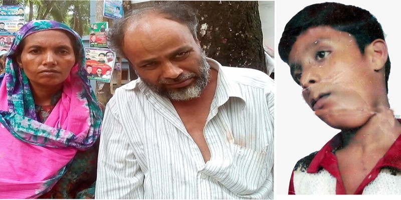 কুমিল্লা মুরাদনগর উপজেলায় একই পরিবারের পাচঁজন বিরল রোগে আক্রান্ত