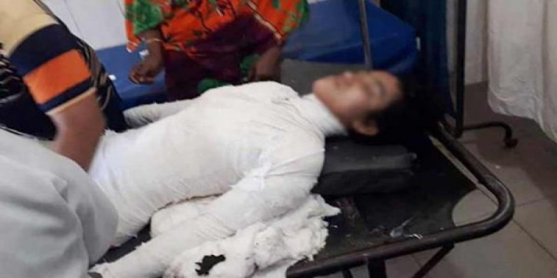 ঢাকা মেডিক্যাল কলেজ হাসপাতালে চিকিৎসাধীন অবস্থায় মাদ্রাসাছাত্রী নুসরাতের মৃত্যু॥