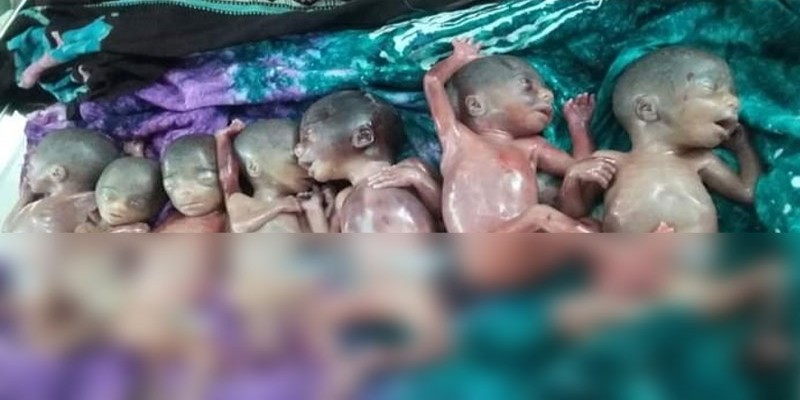 লক্ষ্মীপুরের ৭ সন্তানের জন্ম দিলেন ৫ মাসের প্রসূতি মা॥