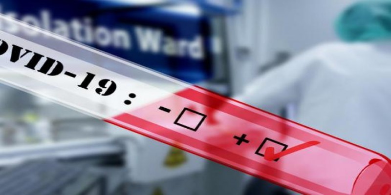 সিলেটে পাঁচ নার্সসহ নতুন করে ১৩ জনের করোনা শনাক্ত॥