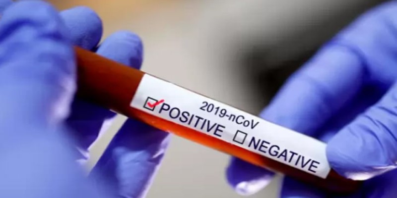 সিলেটে বেড়েই চলেছে করোনা সংক্রমনের সংখ্যা॥ নতুন করে আক্রান্ত আরও ১৮ জন