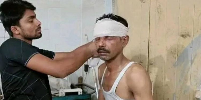চাঁপাইনবাবগঞ্জে ককটেল বিস্ফোরণে শ্রমিক লীগ নেতাসহ আহত ৪।।