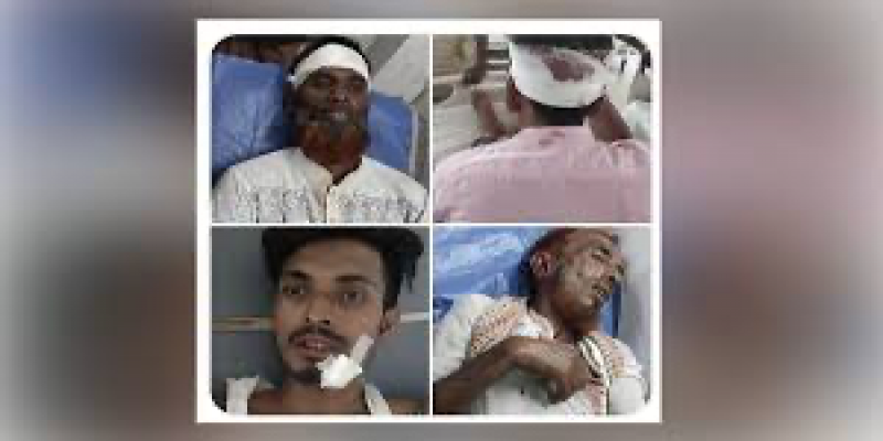 ভৈরবে মসজিদের কমিটি ও ইমাম নিয়োগকে কেন্দ্র করে সংঘর্ষ ।। আহত ২৫