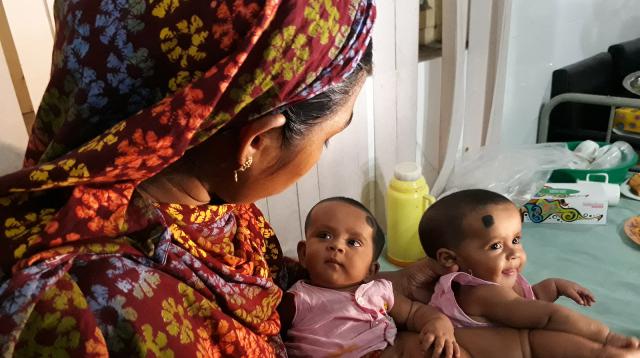 ঢাকা মেডিকেল কলেজ হাসপাতালে গাইবান্ধার জোড়া শিশুর সফল অস্ত্রোপচার সম্পন্ন।।   