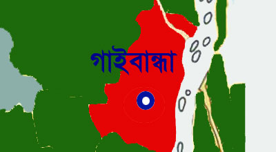 গাইবান্ধার সুন্দরগঞ্জে দুটি অদ্ভুত যমজ শিশুর জন্ম হয়েছে ।।