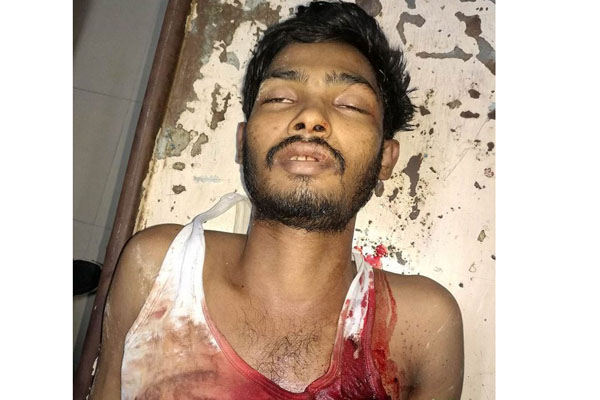 কক্সবাজারে সন্ত্রাসী ইসমাইলের গুলিবিদ্ধ লাশ উদ্ধার।।