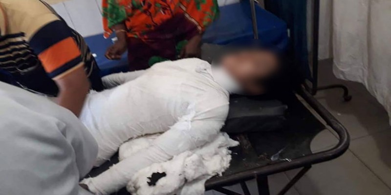 অবশেষে ফেনীর মাদ্রাসাছাত্রীকে পুড়িয়ে হত্যাচেষ্টার ঘটনায় মামলা॥আটক ৭