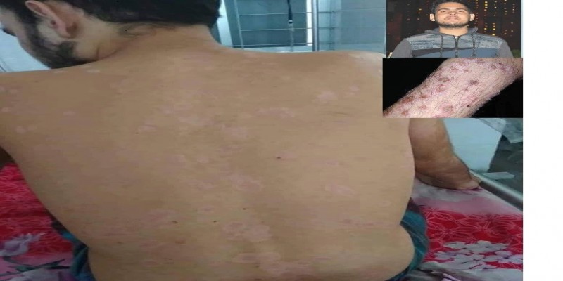 জাবি শিক্ষার্থী ফিরোজকে বাঁচাতে এগিয়ে আসুন