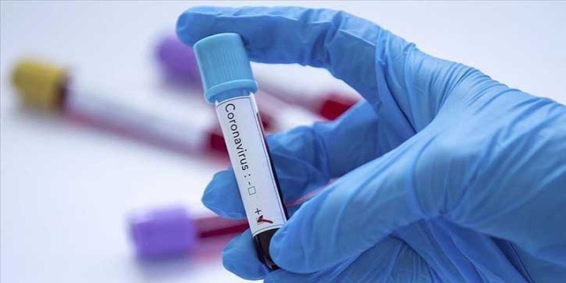 চট্টগ্রামে করোনা আক্রান্তদের ৬৮ শতাংশই তরুণ॥